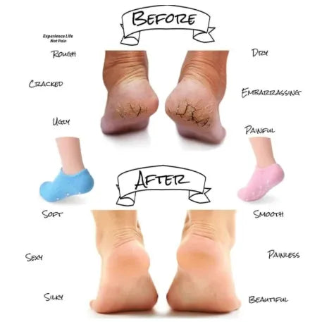 Full Silicone Gel Moisturizing Socks with Essential Oils - Anti-Cracking Foot Care Protector