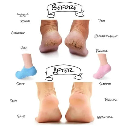 Full Silicone Gel Moisturizing Socks with Essential Oils - Anti-Cracking Foot Care Protector